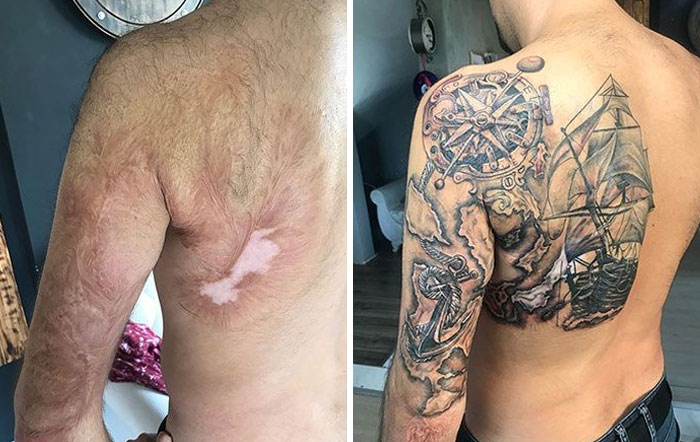 Este tatuaje para cubrir una cicatriz