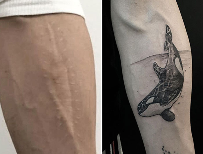 Tatuaje de cobertura de una cicatriz