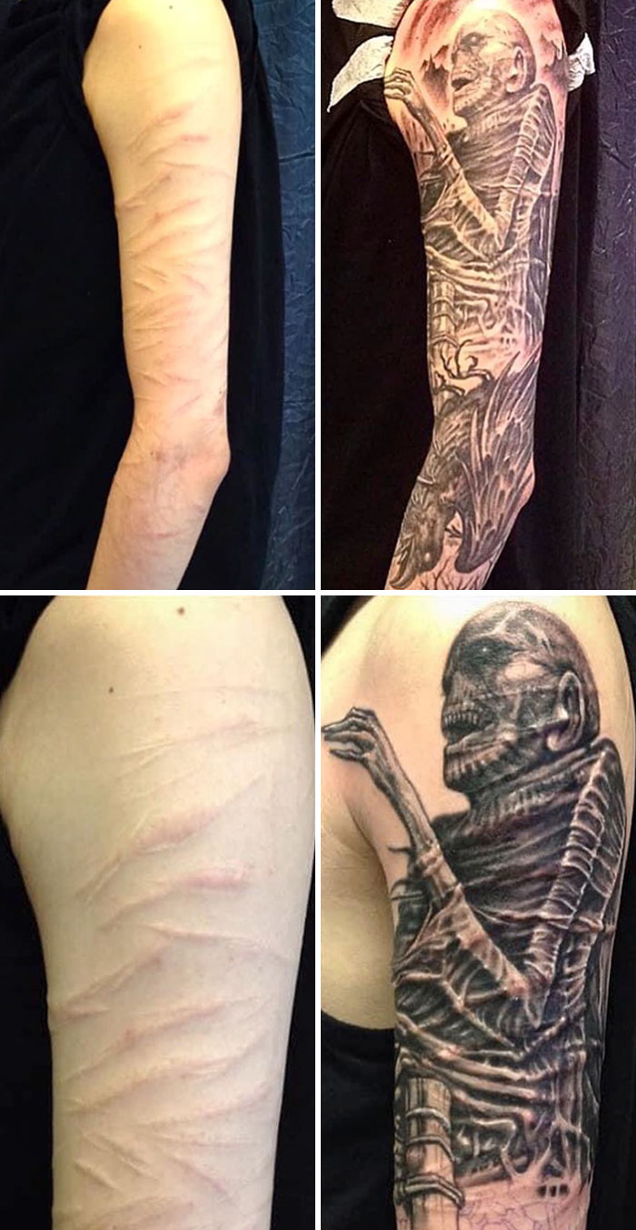 Arm scar covered with detailed tattoo design of a skeleton, showcasing a creative cover-up transformation.