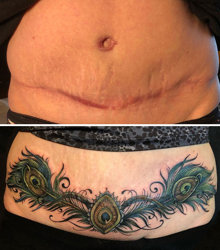 Scar Cover-Up. Really Pleased With This Delicate Piece