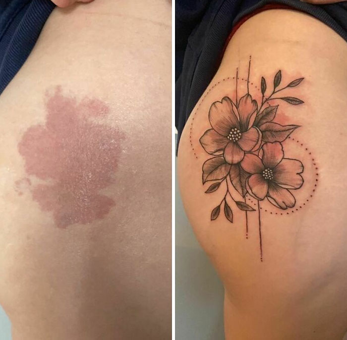 Tattoo artist covers birthmark with floral design, showcasing transformative result.
