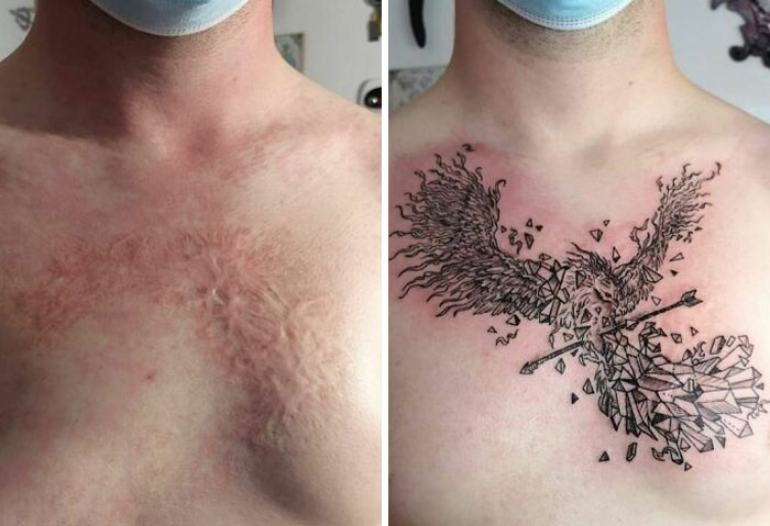 Tattoo cover-up of chest scars with detailed bird design, enhancing appearance and creating a stunning transformation.