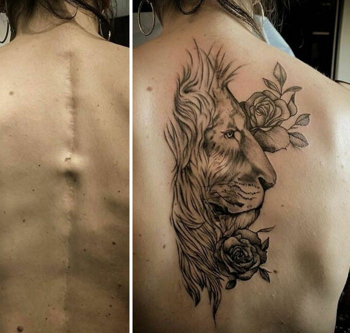 Lion tattoo art beautifully covering a scar on a person's back, resulting in a happier and transformed appearance.
