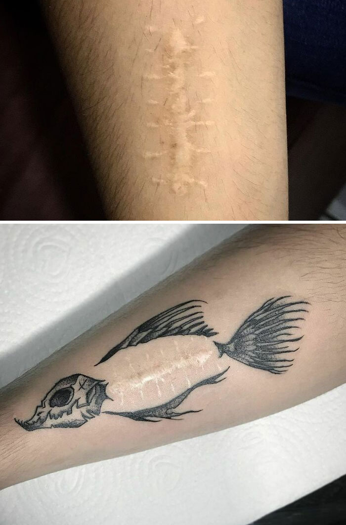 Tattoo artist covers scar with creative skeletal fish design, transforming skin art into a masterpiece.