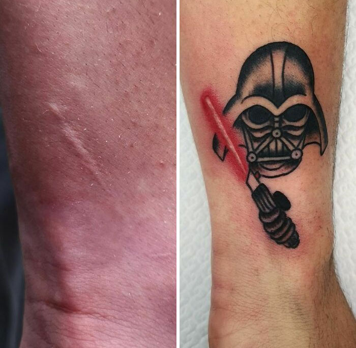 Tattoo covers scars; features a helmet and lightsaber design on forearm.