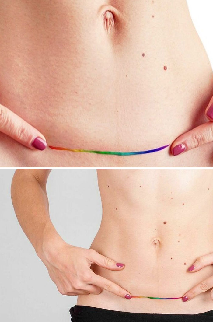 Tattoo covers scar with a rainbow design, transforming a birthmark into art.