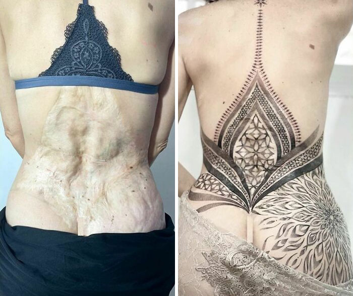 Tattoo cover-up transforms scars into intricate back design, showcasing artistry and happiness at the result.