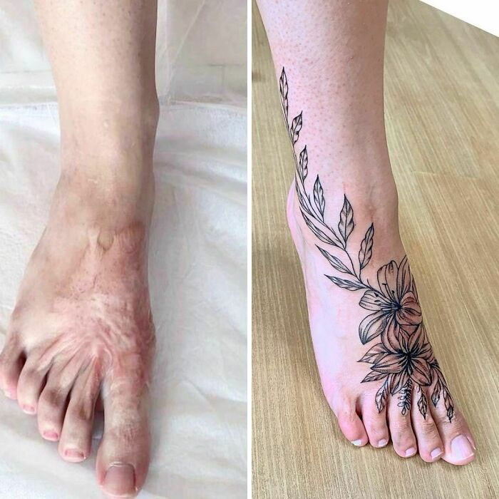 Foot with a floral tattoo beautifully covering previous scar, showcasing stunning tattoo transformations.