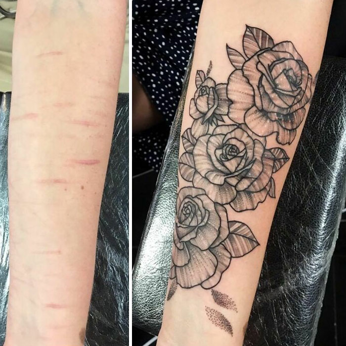 Scar Cover. Would Love To Do More