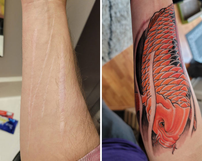 Primera sesión de un tatuaje de cicatriz completada, todavía hay que añadir flores de cerezo y el fondo