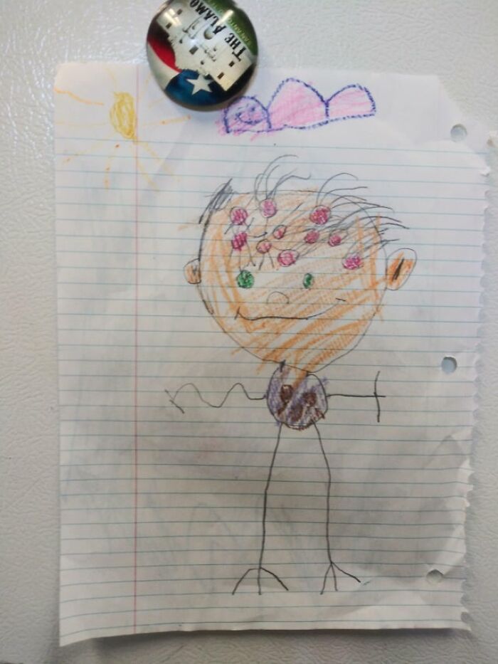 My 4yo Daughter's Artwork. Those Red Circles Are "The Holes Where His Hair Comes Out."