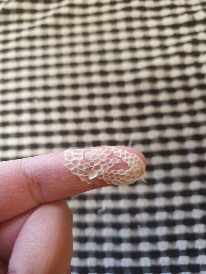 These Gross Looking Flakes Of Raw Chicken Skin (Placed On My Finger For Added Effect)