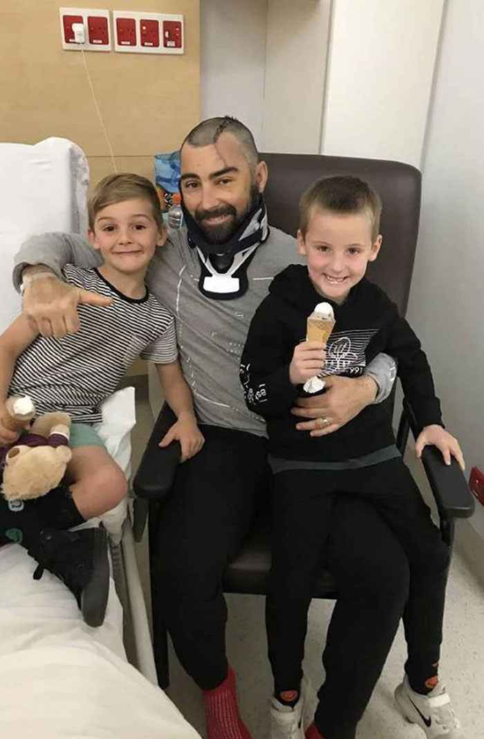 Father Brad Lewis Saved His Youngest Son From Falling Off A Balcony By Jumping After Him