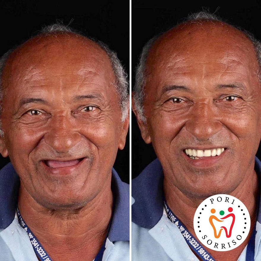 Brazilian Dentist Travels The World To Recover Smiles From People In Needy Communities (32 New Pics)