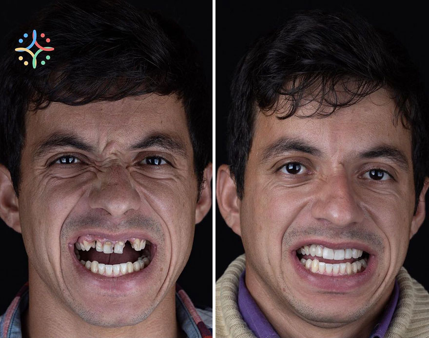 Brazilian Dentist Travels The World To Recover Smiles From People In Needy Communities (32 New Pics)