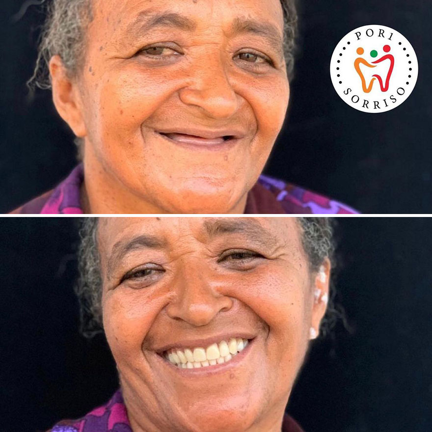 Brazilian Dentist Travels The World To Recover Smiles From People In Needy Communities (32 New Pics)