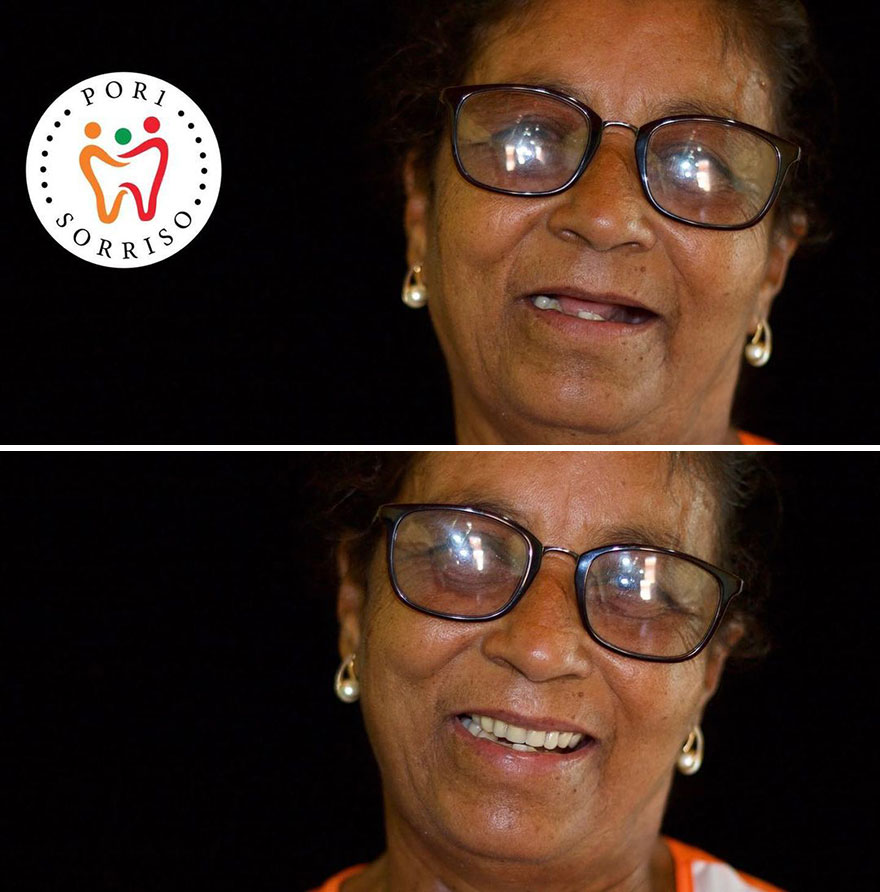 Brazilian Dentist Travels The World To Recover Smiles From People In Needy Communities (32 New Pics)