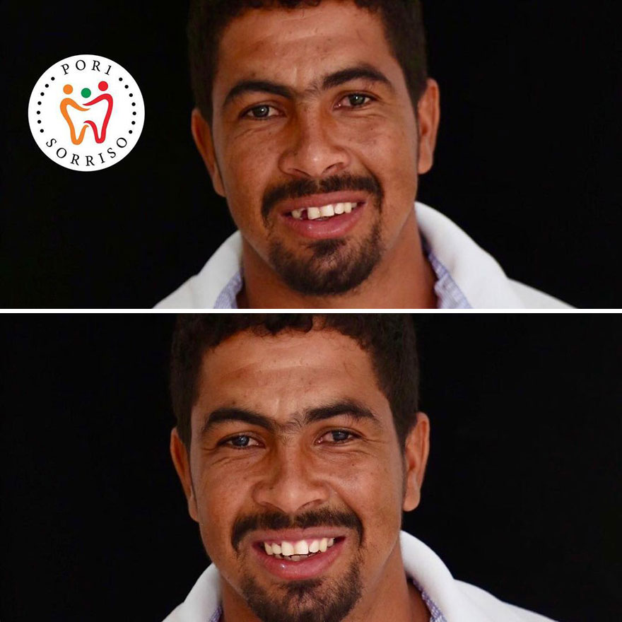 Brazilian Dentist Travels The World To Recover Smiles From People In Needy Communities (32 New Pics)