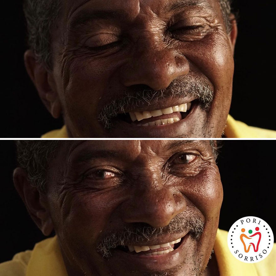 Brazilian Dentist Travels The World To Recover Smiles From People In Needy Communities (32 New Pics)