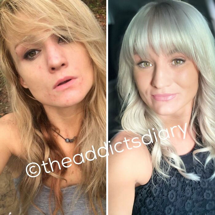 ‘The Addict’s Diary’: 30 Powerful Before & After Transformations Of Drug Addicts (New Stories)