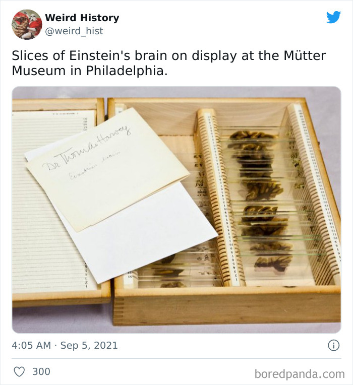 Slices of Einstein's brain displayed in glass slides at the Mütter Museum, a unique weird history and trivia exhibit.