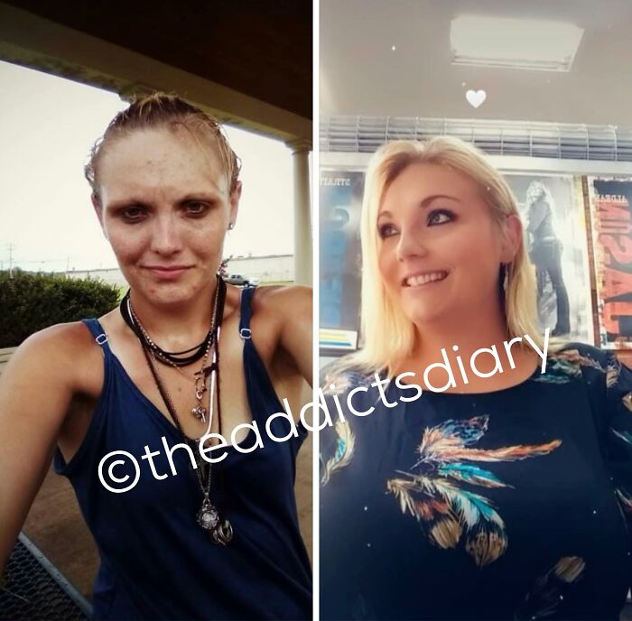 Drug-Addiction-Before-After-Transformation-Photos