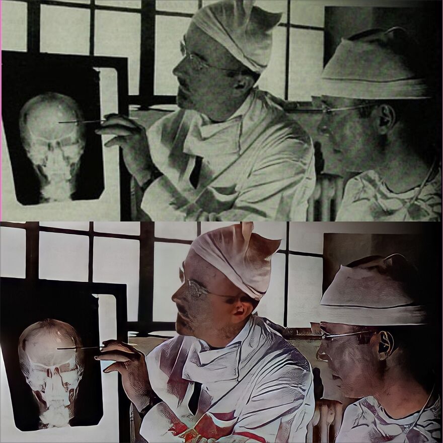 Vintage Asylum Patient Photos Restored. Sad And Scary At The Same Time Vintage Asylum Patient Photos Restored. Sad And Scary At The Same Time