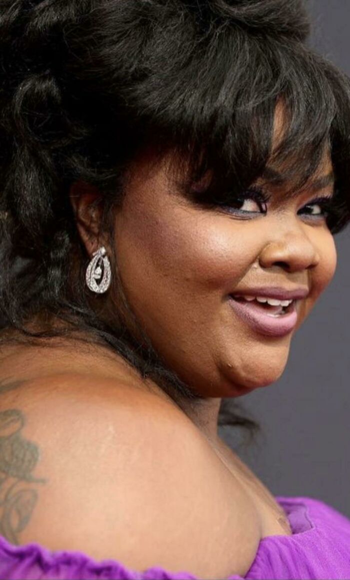 Unafraid To Post Unedited Or Smoothed Red Carpet Photos. Love Her So Much 