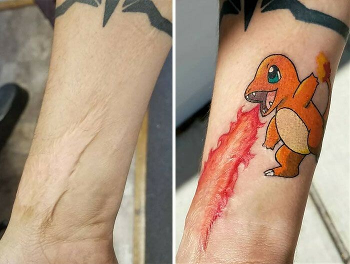Before and after comparison of a person's arm showing their new Charmander tattoo.