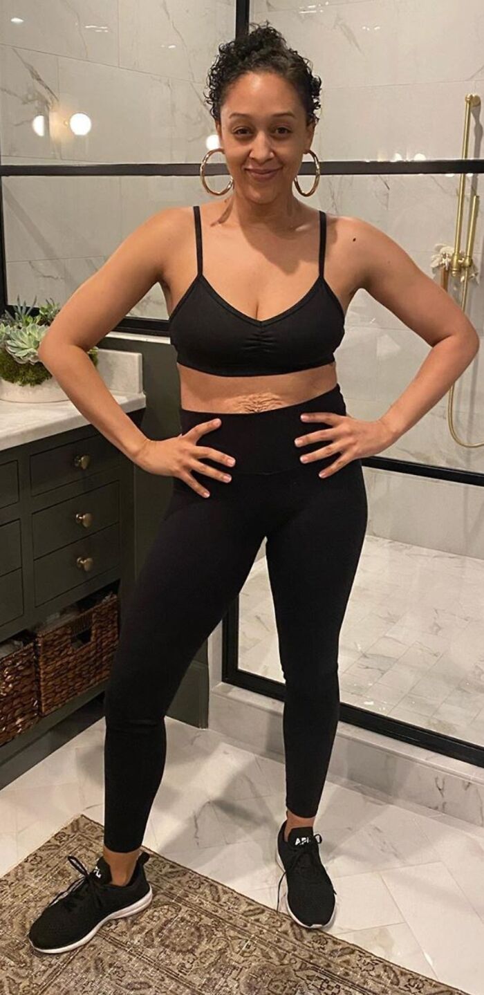 Showing Us Her Healthy Body, Without Editing, And Being Proud To Wear Her Stretch Marks