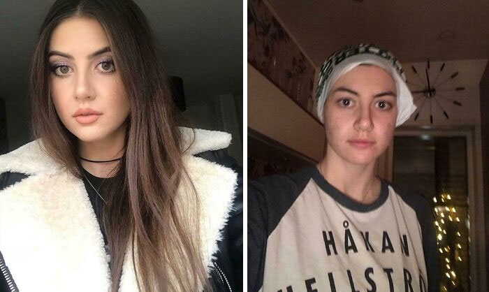 This Insta-Girl Posts Pics On Both ”good” And ”bad” Days And Gives No F**k About It. I Love It