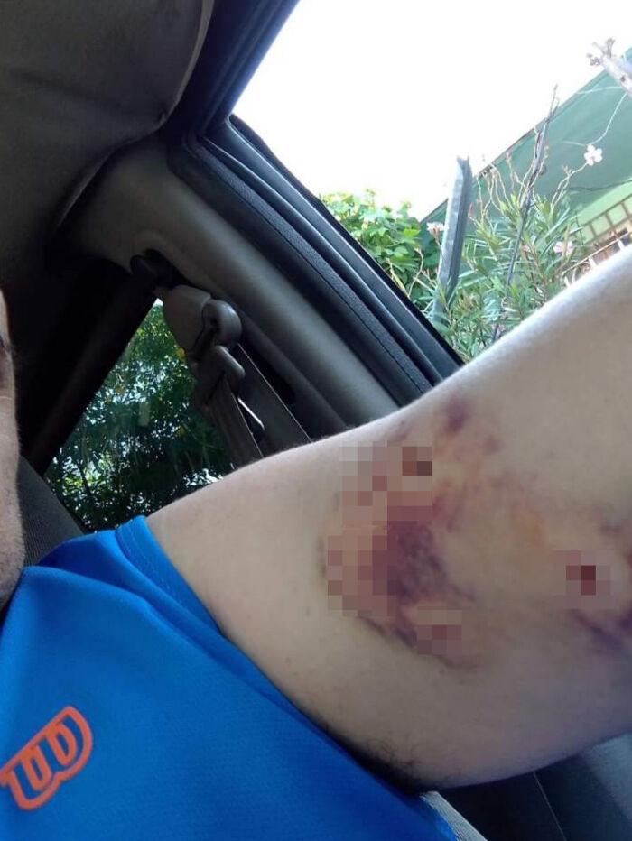 Man Rescued A Dog That Bit Him And His Story Went Viral