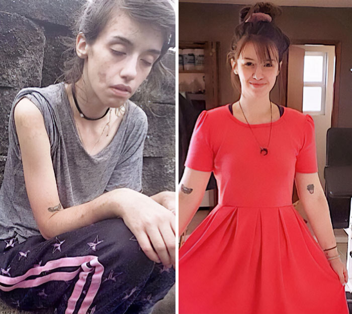 Here’s An Updated Picture Of My Recovery I’m 19 Months Clean And I’m Finally Starting To See The Beauty In Life Again