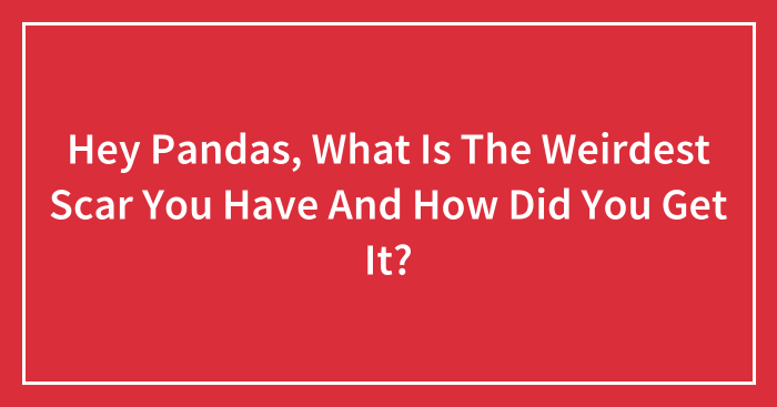 Hey Pandas, What Is The Weirdest Scar You Have And How Did You Get It? (Closed)