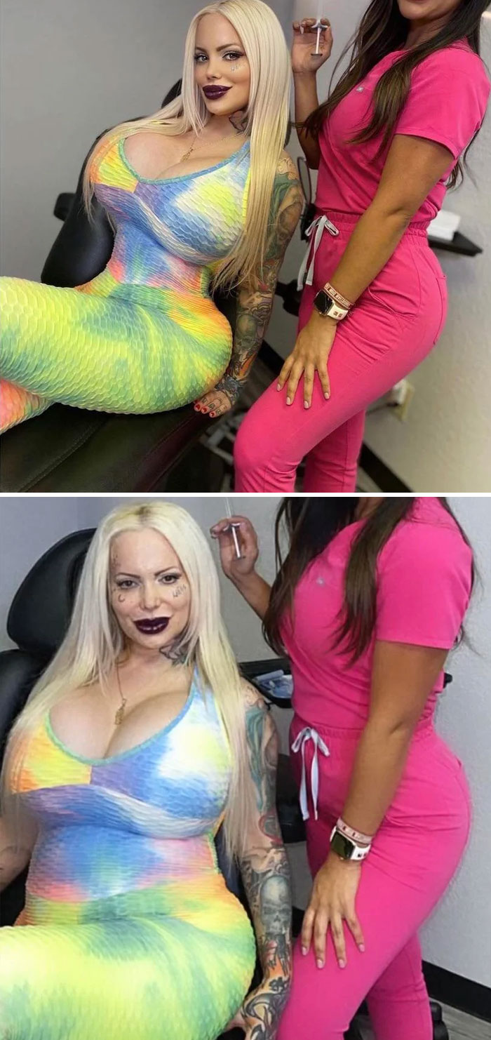 Finally Found One In The Wild! What She Posted vs. What The Clinician Posted