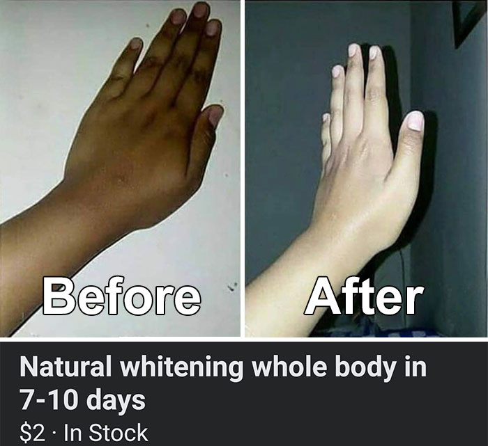 Make Your Skin Lighter In 7 Days Using Camera Flash In Poorly Lit Corner Of Room