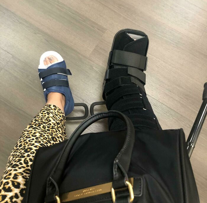 Sprained My Ankle And Decided To Skip The Doctor Visit. In The Darkness Walked Into My Kids’ Trampoline And Broke The Toe On The Other Foot. My Nurses Were Very Impressed