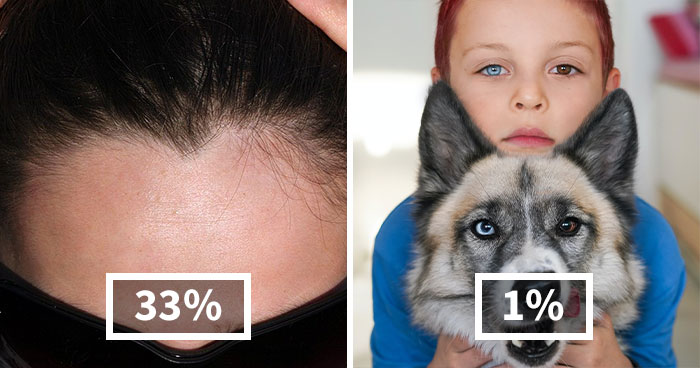 “How Rare Are You?”: Woman Shares Random But Interesting Genetic Facts About Humans And Here’re 30 Of The Best Ones