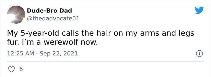 Tweet about a 5-year-old hilariously giving alternative names by calling arm and leg hair fur.