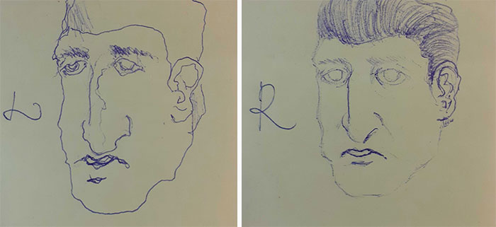 Lynchian Face And A Quasimodo