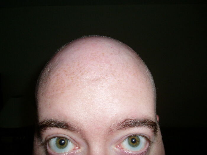 Someone Asked “What Are Some Men’s Issues That Are Overlooked?”, And 30 People Delivered