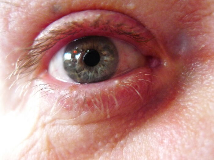 Close-up of a human eye showing detailed skin texture and eyelashes in natural lighting.