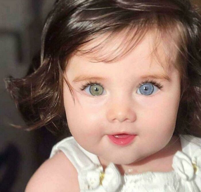 Heterochromia Is A Difference In Coloration, Usually Of The Iris But Also Of Hair Or Skin.