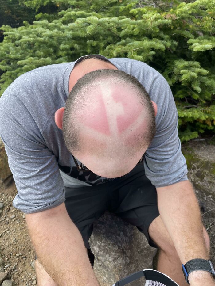 I Wore A Mesh Hat On A 30 Mile Hike. Feeling Like Aang Today