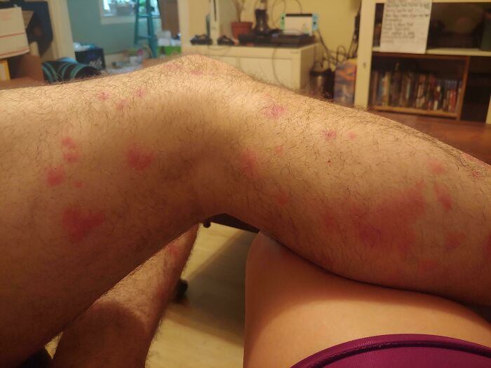 Went Hiking For My Partner's Birthday. There Were Bugs