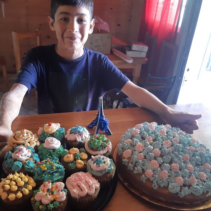 In Argentina, A 10-Year-Old Boy Works As A Confectioner To Pay For His Reconstruction Surgery