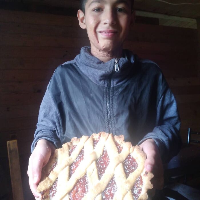 In Argentina, A 10-Year-Old Boy Works As A Confectioner To Pay For His Reconstruction Surgery