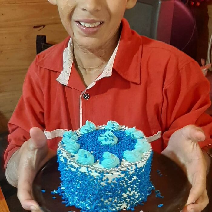 In Argentina, A 10-Year-Old Boy Works As A Confectioner To Pay For His Reconstruction Surgery