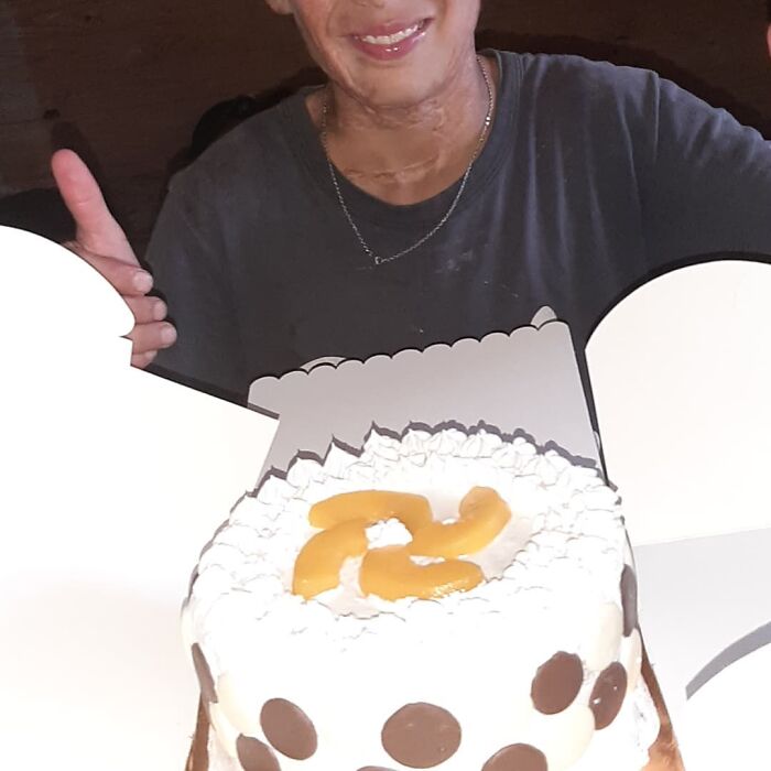 In Argentina, A 10-Year-Old Boy Works As A Confectioner To Pay For His Reconstruction Surgery