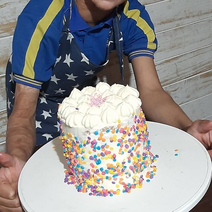 In Argentina, A 10-Year-Old Boy Works As A Confectioner To Pay For His Reconstruction Surgery